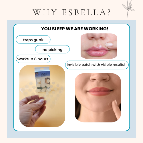 Tea Tree and Salicylic Acid Acne Healing Patches
