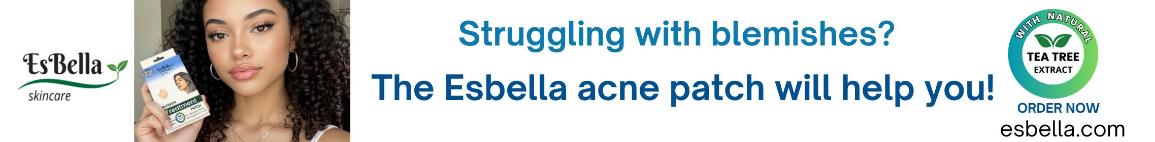 https://esbella.com/wp-content/uploads/2025/08/esbella-banner-728x90-a.jpg